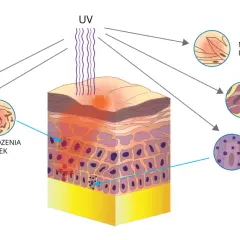 Skóra jako narząd reaguje na UV: wzrost melaniny, uszkodzenia komórek, nadmierne rogowacenie, rozpad białek i wolne rodniki.